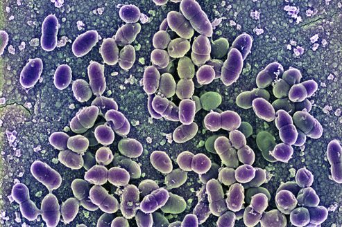 Des bactéries OGM contre l’inflammation des intestins